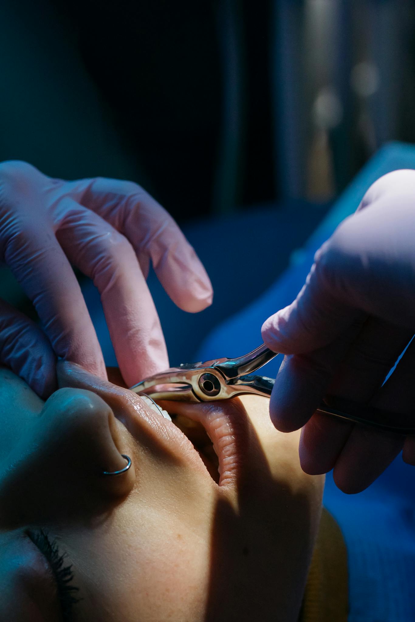 Detailed close-up of a dental procedure with a patient receiving treatment by a dentist.