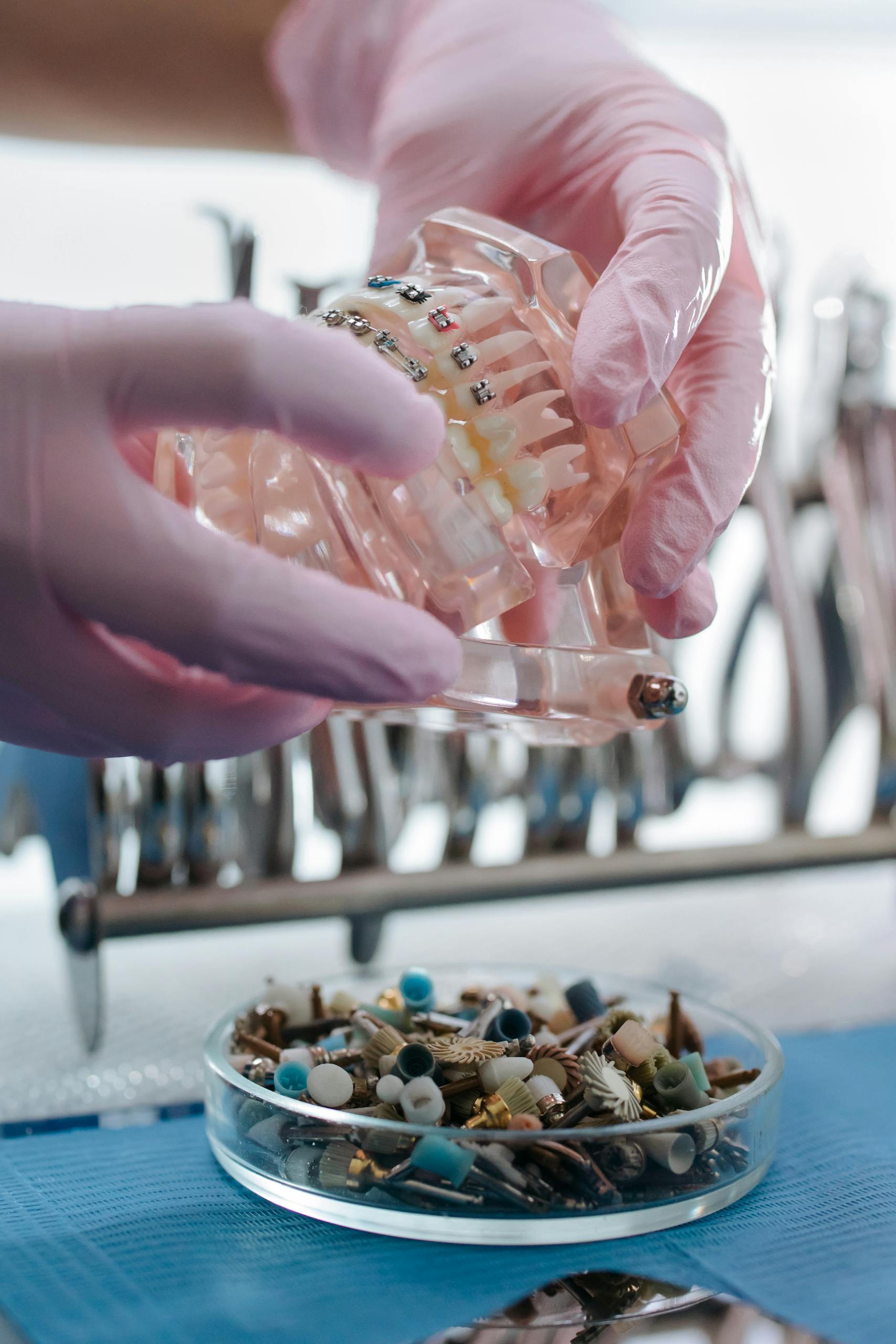 Close-up of dental prosthesis model and tools in a clinic setting with rubber-gloved hands.